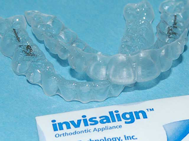 BracesInvisalign